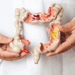 Proteína pode diminuir tumor de câncer colorretal em 77%, descobrem cientistas
