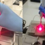 Laser ajuda a combater hipertensão provocada pela menopausa; estudo brasileiro